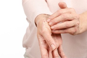 Con 79 años, Donald Trump fue diagnosticado con insuficiencia venosa crónica tras notar hinchazón en piernas y manos. Cuáles son las causas, síntomas y las mejores estrategias para sobrellevarla.